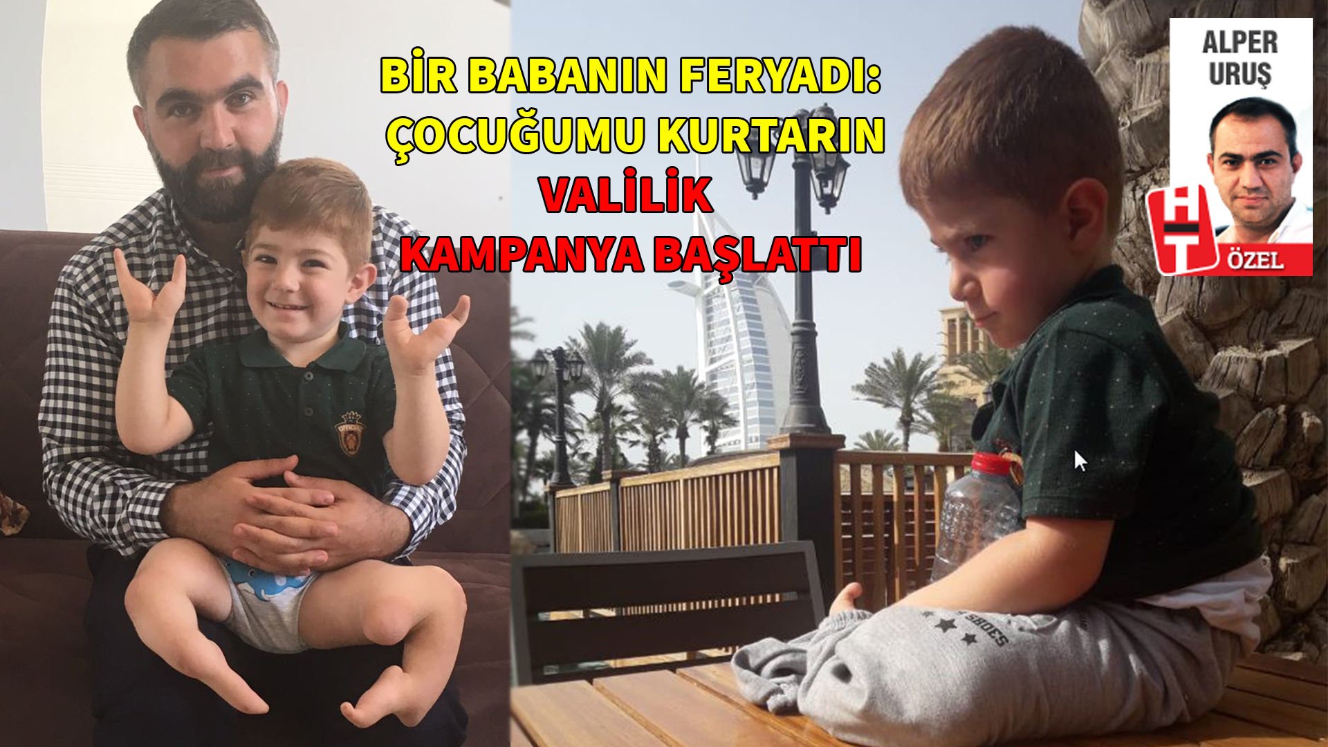 Milyonda bir görülen hastalık onu buldu Milyonda bir görülen hastalık onu buldu