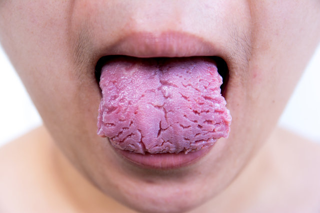   </strong></p>
</p>
<p>  </strong></p>
</p>
<p>  1 </strong></p>
</p>
<p>  The most common symptom of tongue cancer is tongue wound. Language cancer is caused by tongue cancer. [19659000] 4 [19659000] </span><br />
                                        <span>  8 </span>
                                    </p>
<div class=