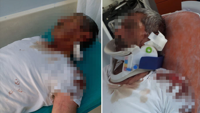 Van'da bir camide 'kulağımı ısırarak koparttı' iddiası