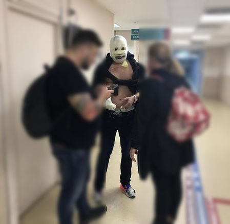 Alev şovu kazasının ardından Nusret'ten açıklama