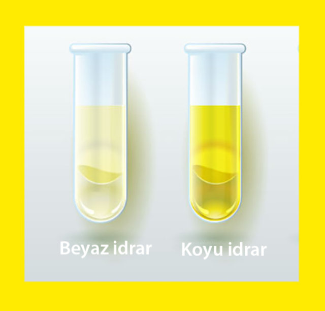 İdrar rengine dikkat! Kanser belirtisi olabilir...