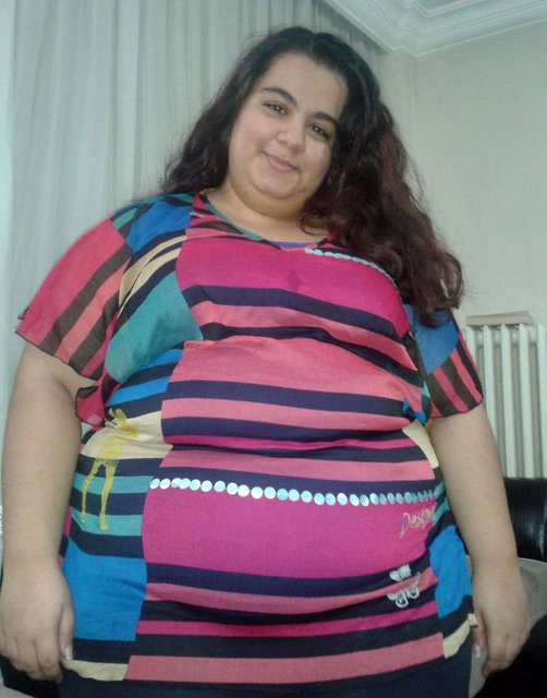 Beste Eylül Aydemir lost 95 kg in 15 months!