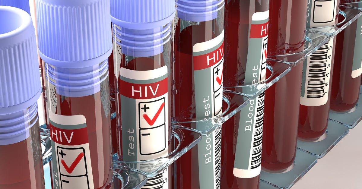 AIDS nedir? AIDS belirtileri nelerdir? AIDS nasıl bulaşır?