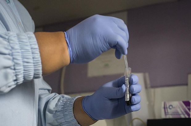 1 Aralık Dünya AIDS Günü AIDSi bilmiyoruz 1 Aralık Dünya AIDS Günü AIDSi bilmiyoruz