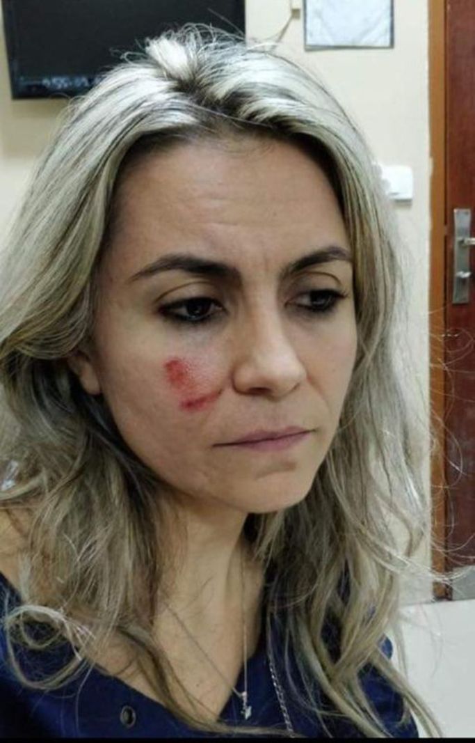 Çürük raporu vermeyen kadın doktoru darp etti!
