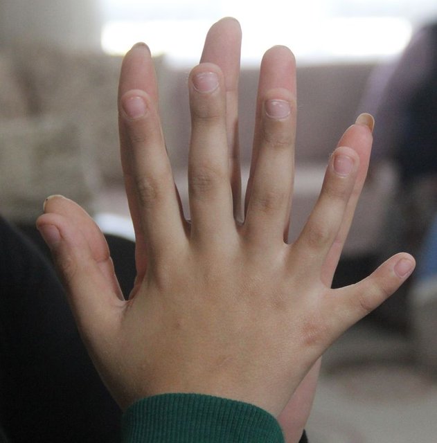 24 parmaklı Demirhan Demirbilek'in ayakkabı çilesi!
