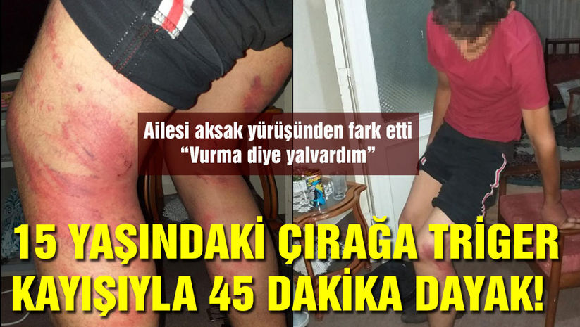 Konyada 15 yaşındaki çırağa feci dayak: Vurma diye yalvardım ama durmadı