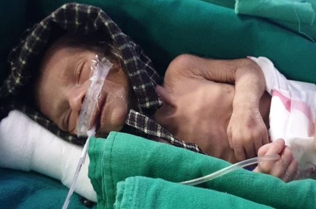 Hindistan'da canlı halde gömülmüş kız bebek bulundu
