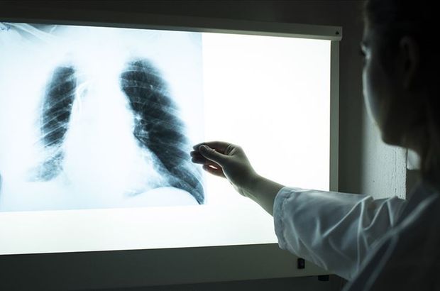 Aşırı kiloluların akciğerlerinde astıma yol açan yağ dokusu tespit edildi

