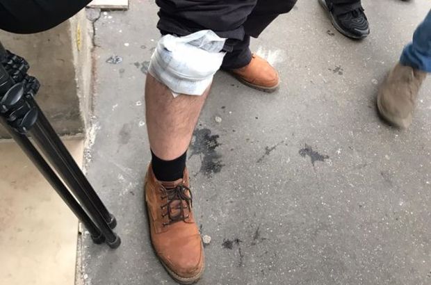 AA Foto Muhabiri Paris'te yaralandı