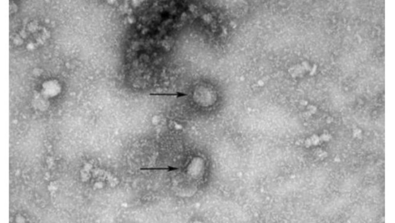 Koronavirüsün mikroskopla çekilen görüntüsü yayınlandı! - Haberler