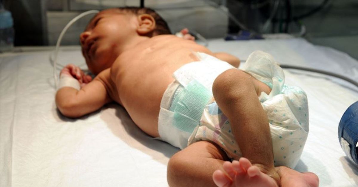 Her yıl 15 bin bebek doğumsal kalp hastalığıyla doğuyor