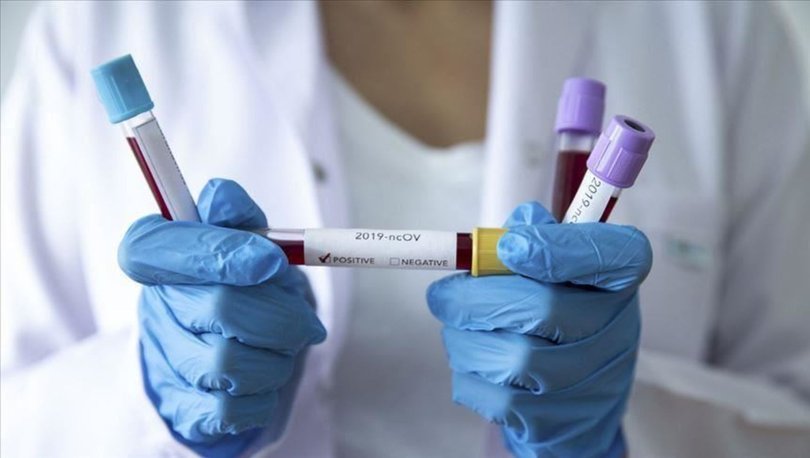 FLAŞ! Meksika'da ilk koronavirüs vakaları tespit edildi