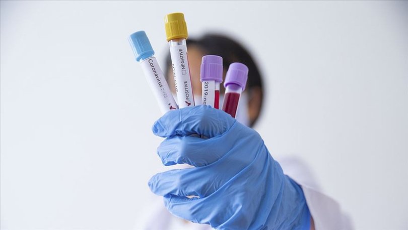 Japonya Genelinde Corona Virus Nedeniyle Ohal Ilan Edildi Sondakika Haberler