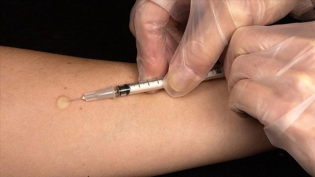 Son Dakika! Koronavirüsün başka belirtileri ortaya çıktı! Corona virüs belirtileri neler? - Haberler
