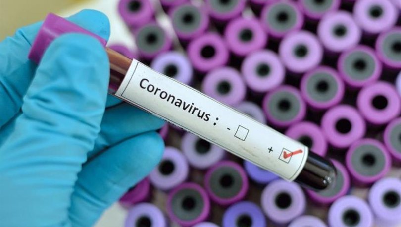 Corona Virus Testi Online Nasil Yapilir Koronaonlem Saglik Gov Tr Online Koronavirus Testi Saglik Haberleri