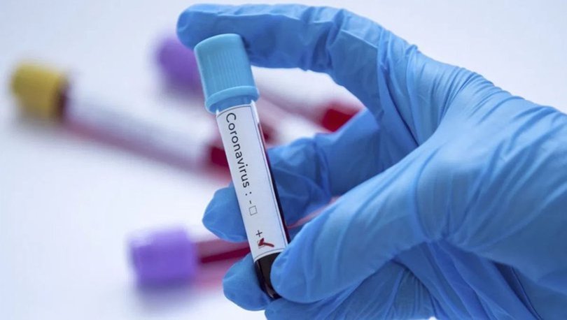 İngiltere'de 13 yaşındaki çocuk koronavirüs nedeniyle öldü