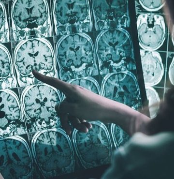 Ege Ãniversitesi TÄ±p FakÃ¼ltesi 4. sÄ±nÄ±f Ã¶Ärencisi ÃaÄÄ±l Kalender, hocalarÄ±nÄ±n desteÄiyle yÃ¼rÃ¼ttÃ¼ÄÃ¼ Ã§alÄ±Åmalarda Alzheimer hastalÄ±ÄÄ± ve tedavi mekanizmalarÄ± konusunda Ã¶nemli mesafe aldÄ±