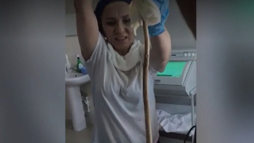 Rusya'da ağacın altından uyuyan kadının ağzından giren yılan ameliyatla çıkarıldı