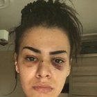 SOKAK ORTASINDA ÖNCE TACİZ ARDINDAN DARP!