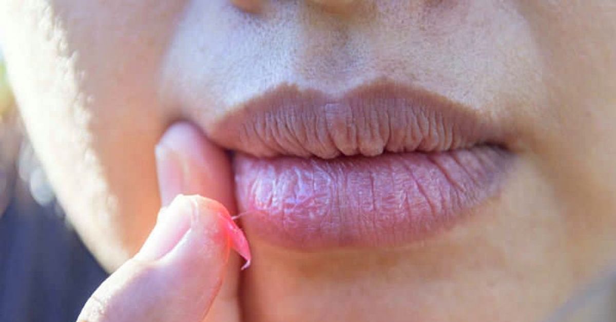 dudak morarmasi neden olur saglik haberleri