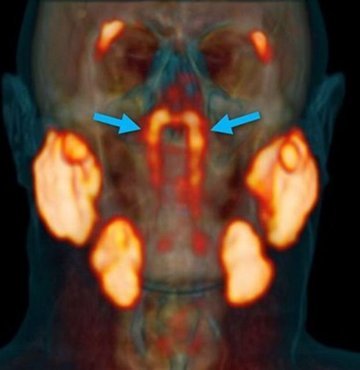 Bilim insanları, kafatasında daha önce ne olduğu tanımlanmamış bir organ buldukları bildirildi.