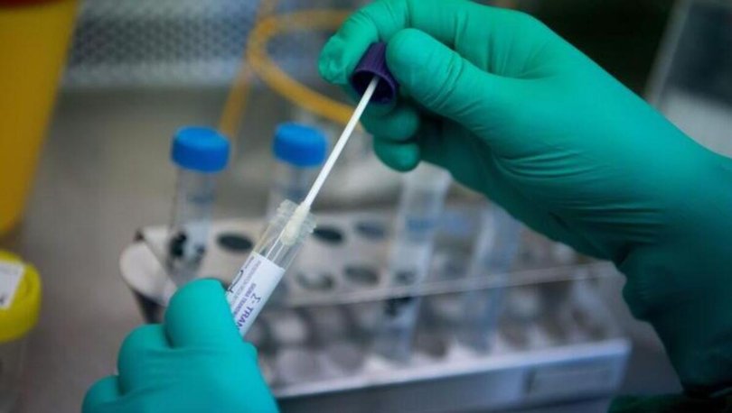 covid 19 test ucreti ne kadar koronavirus pcr test ucreti 2020 covid 19 testi yapan hastaneler saglik haberleri