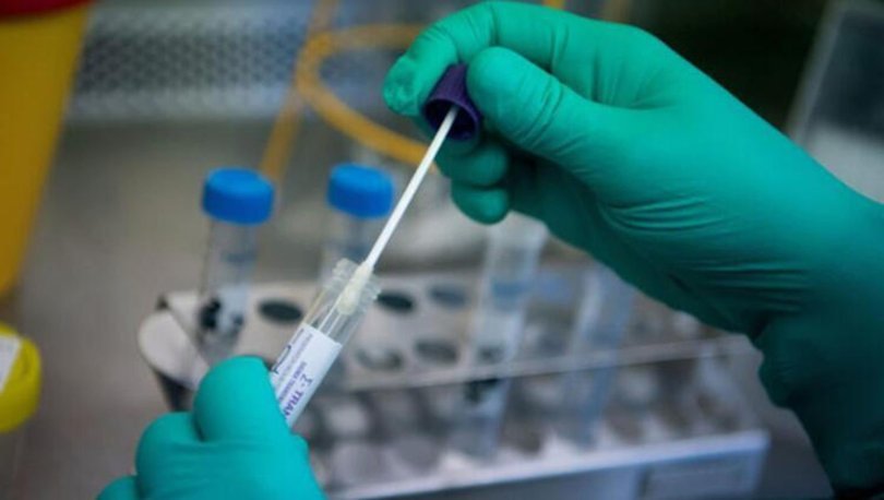 Covid-19 test ücreti ne kadar? Koronavirüs PCR test ücreti 2020