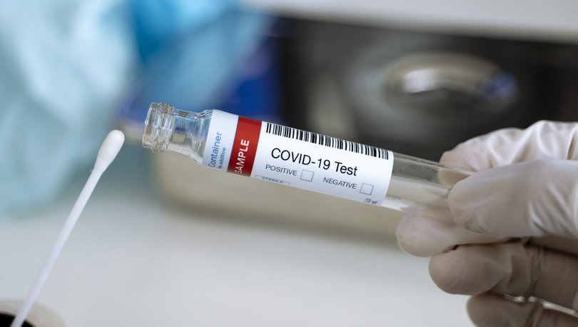 e-Nabız covid-19 test sonucu sorgulama ekranı! Korona virüs testi sonucu öğrenme nasıl yapılır?