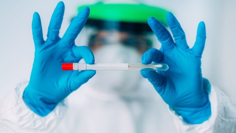 covid 19 test ucreti ne kadar koronavirus pcr test ucreti ve antikor testi ucreti nedir saglik haberleri