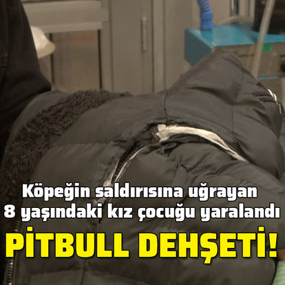 Kırıkkale'de pitbull dehşeti! 8 yaşındaki kız çocuğuna saldırdı