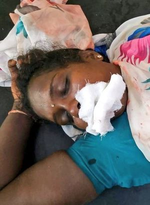 Hindistan'da bir kadın desteklediği parti seçimleri kazanınca dilini kesti