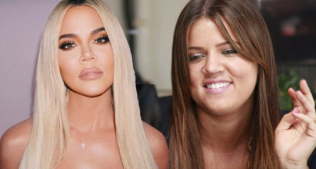 Khloe Kardashian'dan 'Estetik' itirafı: Sadece burnumu yaptırdım - Magazin haberleri