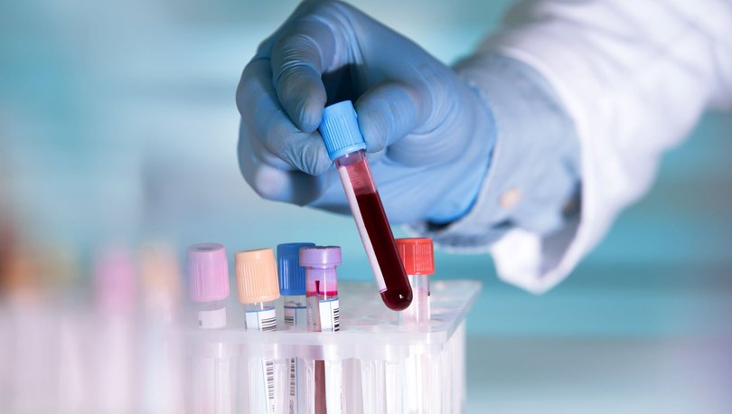 50 kanser türünü doğru tespit eden kan testi! - Haberler