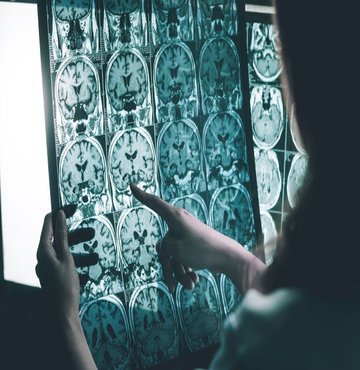 Tüm demansların yaklaşık yüzde 70’ini Alzheimer tipi demans oluşturuyor. Hastalıktan korunmada, genetik faktörler dışında en önemli şeyin zihinsel olarak beynin aktif tutulması ve yapılacak şeylerin çoğunun bizim elimizde olduğu belirtiliyor. Uzmanların, “Rutin yaşam alışkanlıklarını bir kenara bırak ve yeni şeyler öğren” mesajının doğru okunması ve uygulanması ise Alzheimer’dan korunmada önemli sonuçlar veriyor. Ceyda Erenoğlu’nun haberi