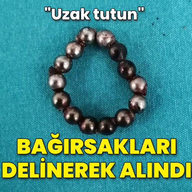 Bağırsakları delinerek alındı! Çocuklardan uzak tutun
