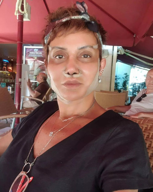Serap Paköz�ün son hali sosyal medyada olay oldu Başkası gibi