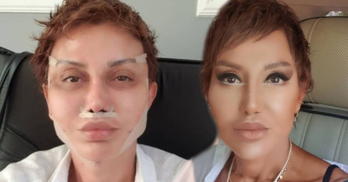 Serap Paköz�ün son hali sosyal medyada olay oldu Başkası gibi