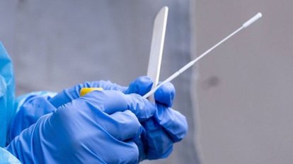 PCR testi nedir, nasıl yapılıyor? 