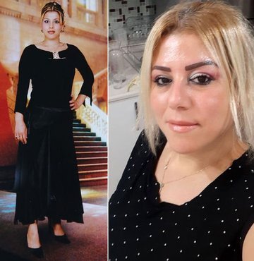Her satırı korkunç! Öldüren estetik!