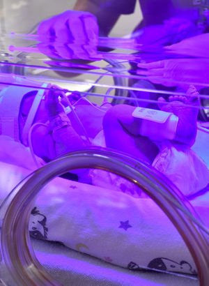 koltuk alti agrisi neden olur koltuk alti agrisi nasil gecer saglik haberleri