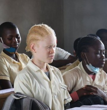 Genetik olarak cilde renk veren “melanin” adlı pigmentin eksikliğiyle ortaya çıkan albinizme sahip bireyler, Kamerun’da büyü ve batıl inanç tehdidi altında yaşıyor