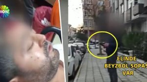 Beyzbol sopası ile saldırdı, serbest bırakıldı!