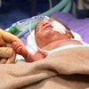 Parmak bebeğe kalp ameliyatı 