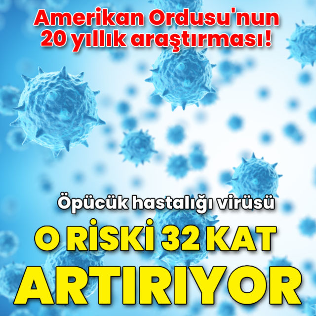 Öpücük hastalığı virüsü, MS riskini 32 kat artırıyor 