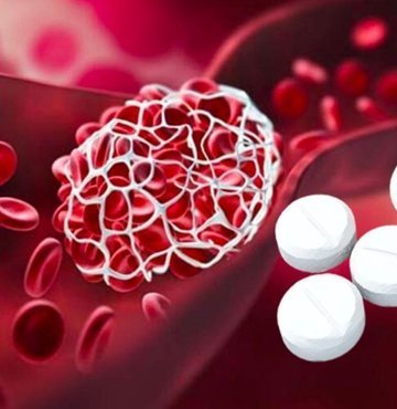 Almanya’da 12 binden fazla kişinin dahil edildiği 5 yıl süren bir çalışmada, aspirinin kalp - damar hastalıklarını önlemede sağladığı yararın kanama nedenli kaybolduğu görüldü. Bu sonuç da aspirinin bir yandan kalp krizini önlemeyi sağlarken diğer yandan ölümcül kanama riskine yol açabileceğine işaret ediyor. Uzmanlar, “Bilinçsiz kullanımdan uzak durun ve doktor önerisi olmadan kan sulandırıcı almayın” diyor ve birincil koruma amaçlı aspirin kullanımını kısıtladıklarını söylüyor. Habertürk Sağlık Yazarı Ceyda Erenoğlu’nun haberi