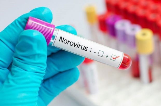 Norovirüs nedir, belirtileri nelerdir?
