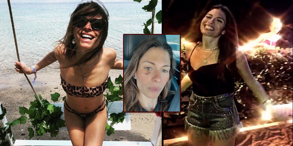 Tatilde talihsiz kaza!