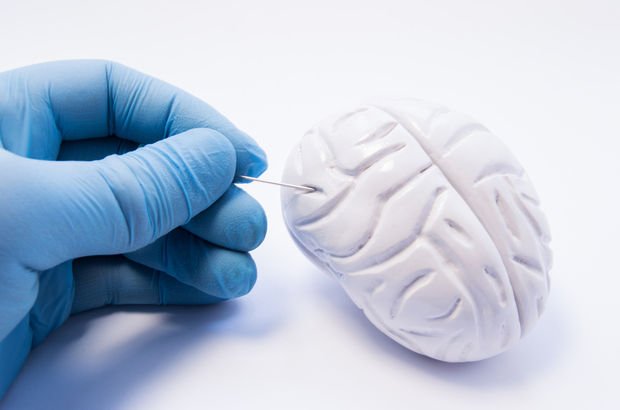 Beyin Tümörü Belirtileri ve Tedavisi