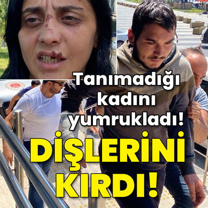 Son dakika:  Zonguldak'ta tanımadığı kadını yumrukladı! Dişlerini kırdı! - Haberler